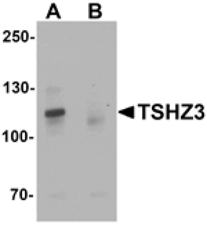 Western blot - TSHZ3 Antibody from Signalway Antibody (25459) - Antibodies.com