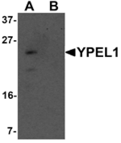 Western blot - YPEL1 Antibody from Signalway Antibody (25462) - Antibodies.com