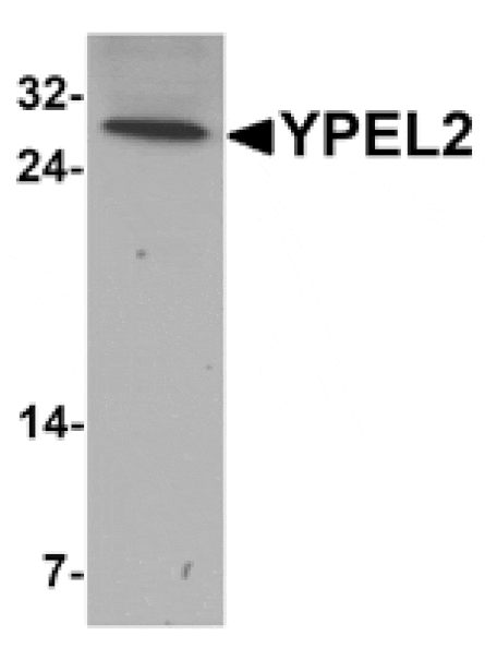 Western blot - YPEL2 Antibody from Signalway Antibody (25463) - Antibodies.com