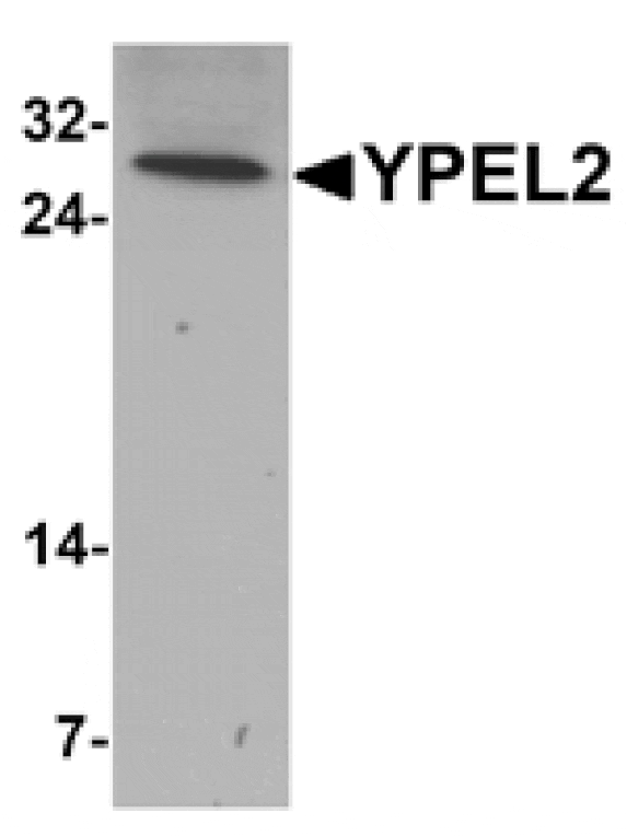Western blot - YPEL2 Antibody from Signalway Antibody (25463) - Antibodies.com