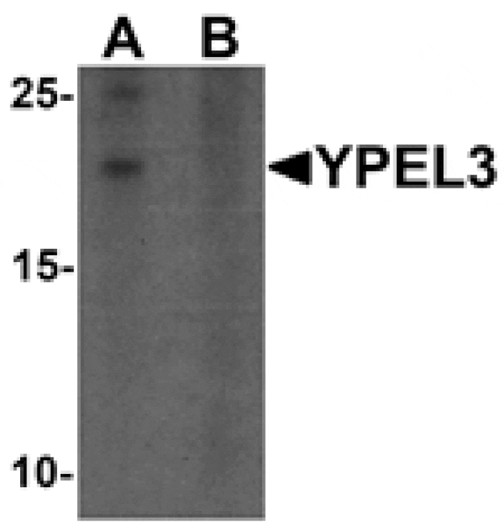 Western blot - YPEL3 Antibody from Signalway Antibody (25464) - Antibodies.com