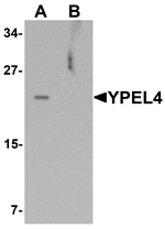 Western blot analysis of YPEL4 in SW480 cell lysate with YPEL4 antibody at 1 µg/mL in (A) the absence and (B) the presence of blocking peptide.