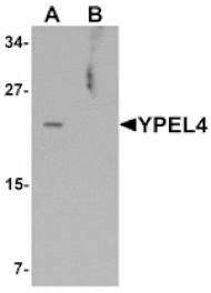 Western blot - YPEL4 Antibody from Signalway Antibody (25465) - Antibodies.com
