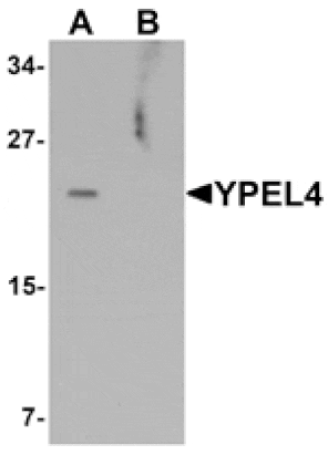 Western blot - YPEL4 Antibody from Signalway Antibody (25465) - Antibodies.com