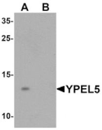 Western blot - YPEL5 Antibody from Signalway Antibody (25466) - Antibodies.com