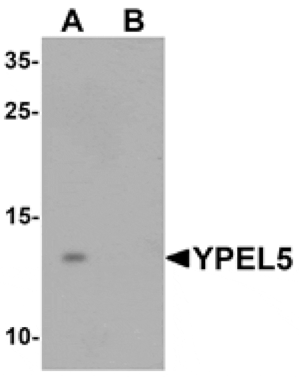 Western blot - YPEL5 Antibody from Signalway Antibody (25466) - Antibodies.com