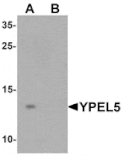 Western blot - YPEL5 Antibody from Signalway Antibody (25466) - Antibodies.com