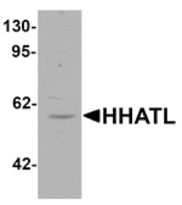 Western blot - HHATL Antibody from Signalway Antibody (25470) - Antibodies.com