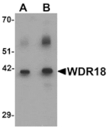 Western blot - WDR18 Antibody from Signalway Antibody (25480) - Antibodies.com