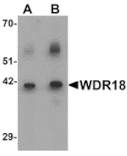 Western blot - WDR18 Antibody from Signalway Antibody (25480) - Antibodies.com