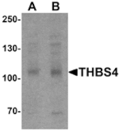 Western blot - THBS4 Antibody from Signalway Antibody (25489) - Antibodies.com
