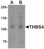 Western blot - THBS4 Antibody from Signalway Antibody (25489) - Antibodies.com