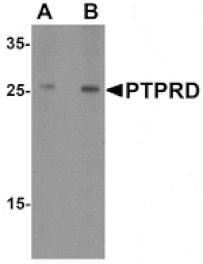 Western blot - PTPRD Antibody from Signalway Antibody (25495) - Antibodies.com