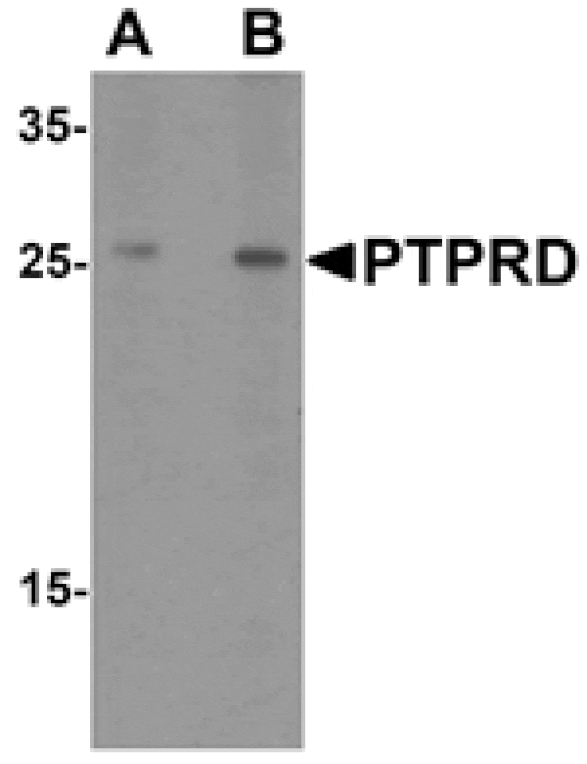 Western blot - PTPRD Antibody from Signalway Antibody (25495) - Antibodies.com