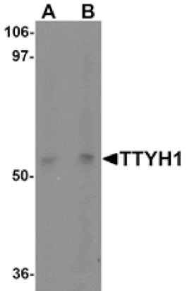 Western blot - TTYH1 Antibody from Signalway Antibody (25497) - Antibodies.com