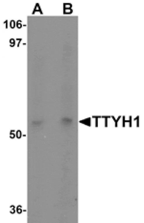 Western blot - TTYH1 Antibody from Signalway Antibody (25497) - Antibodies.com
