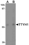 Western blot - TTYH1 Antibody from Signalway Antibody (25497) - Antibodies.com