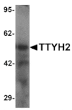 Western blot - TTYH2 Antibody from Signalway Antibody (25498) - Antibodies.com