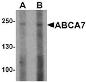 Western blot - ABCA7 Antibody from Signalway Antibody (25499) - Antibodies.com
