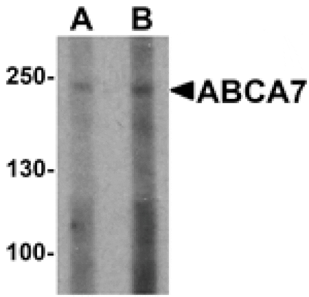 Western blot - ABCA7 Antibody from Signalway Antibody (25499) - Antibodies.com