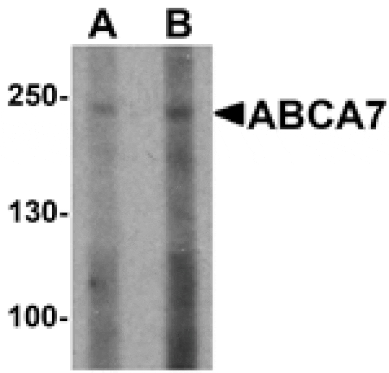 Western blot - ABCA7 Antibody from Signalway Antibody (25499) - Antibodies.com