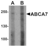 Western blot - ABCA7 Antibody from Signalway Antibody (25499) - Antibodies.com