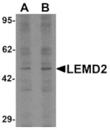 Western blot - LEMD2 Antibody from Signalway Antibody (25500) - Antibodies.com