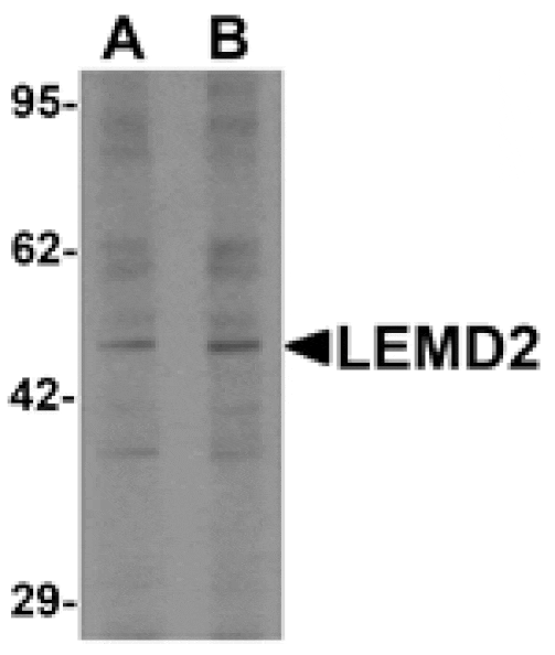 Western blot - LEMD2 Antibody from Signalway Antibody (25500) - Antibodies.com