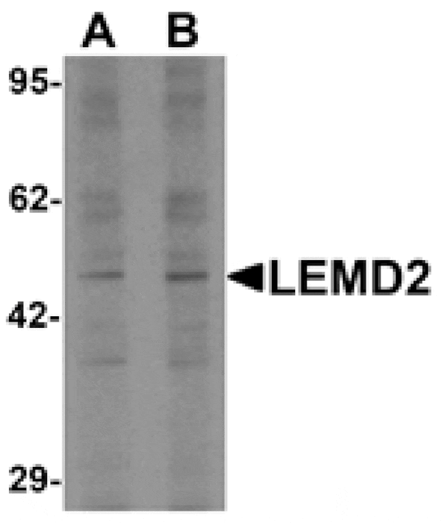Western blot - LEMD2 Antibody from Signalway Antibody (25500) - Antibodies.com