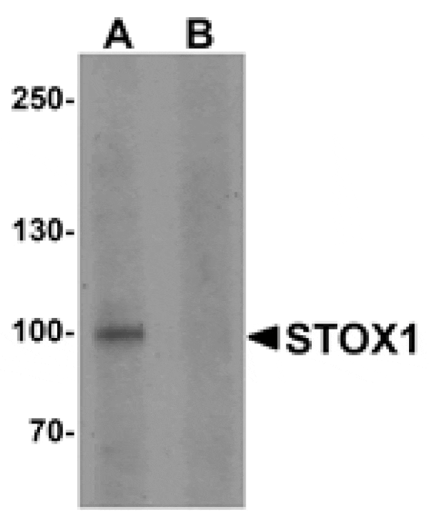 Western blot - STOX1 Antibody from Signalway Antibody (25501) - Antibodies.com
