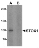 Western blot - STOX1 Antibody from Signalway Antibody (25501) - Antibodies.com
