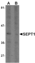 Western blot - SEPT1 Antibody from Signalway Antibody (25502) - Antibodies.com