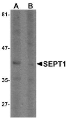 Western blot - SEPT1 Antibody from Signalway Antibody (25502) - Antibodies.com