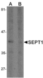 Western blot - SEPT1 Antibody from Signalway Antibody (25502) - Antibodies.com