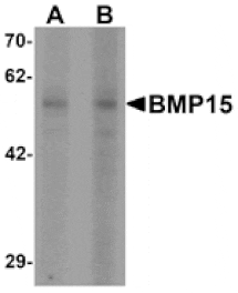Western blot - BMP15 Antibody from Signalway Antibody (25504) - Antibodies.com