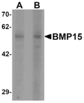 Western blot - BMP15 Antibody from Signalway Antibody (25504) - Antibodies.com