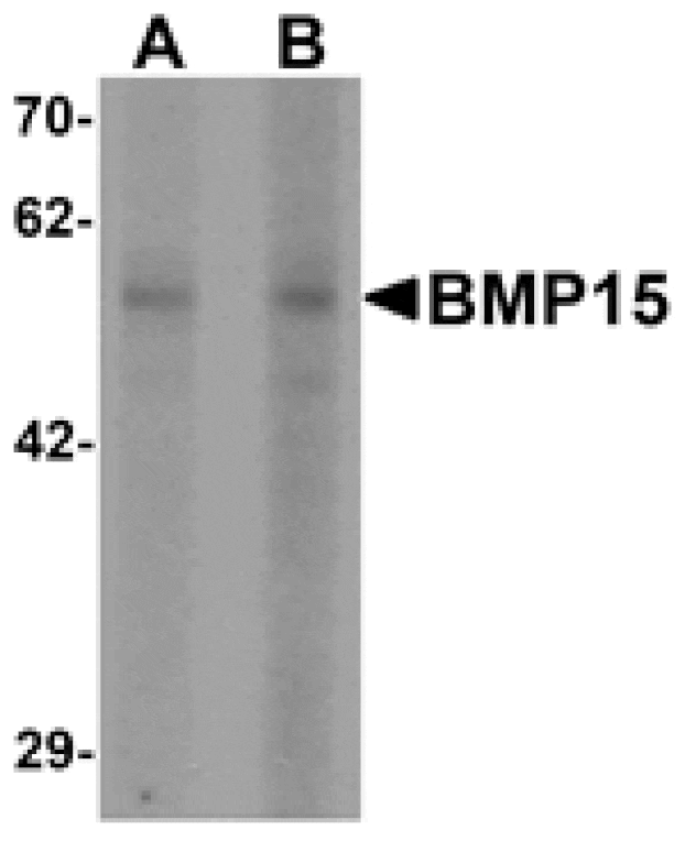 Western blot - BMP15 Antibody from Signalway Antibody (25504) - Antibodies.com