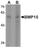 Western blot - BMP15 Antibody from Signalway Antibody (25504) - Antibodies.com