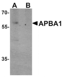 Western blot - APBA1 Antibody from Signalway Antibody (25509) - Antibodies.com