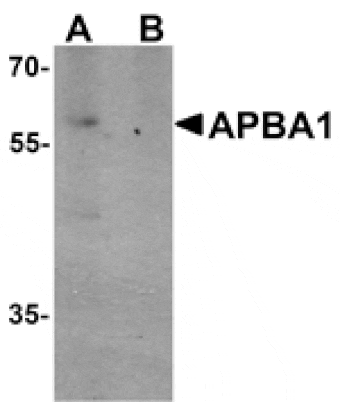 Western blot - APBA1 Antibody from Signalway Antibody (25509) - Antibodies.com