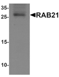 Western blot - RAB21 Antibody from Signalway Antibody (25510) - Antibodies.com