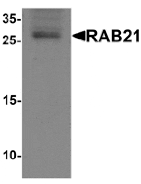 Western blot - RAB21 Antibody from Signalway Antibody (25510) - Antibodies.com