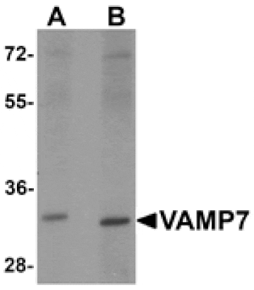 Western blot - VAMP7 Antibody from Signalway Antibody (25511) - Antibodies.com