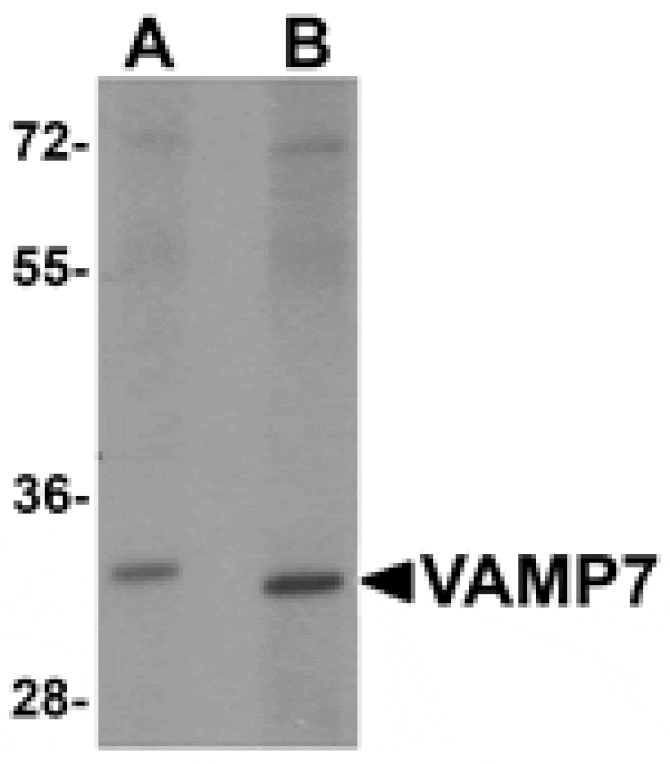Western blot - VAMP7 Antibody from Signalway Antibody (25511) - Antibodies.com