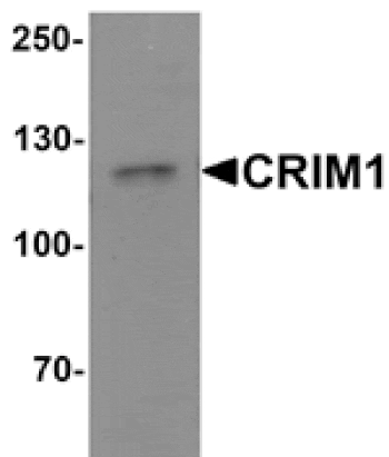 Western blot - CRIM1 Antibody from Signalway Antibody (25516) - Antibodies.com