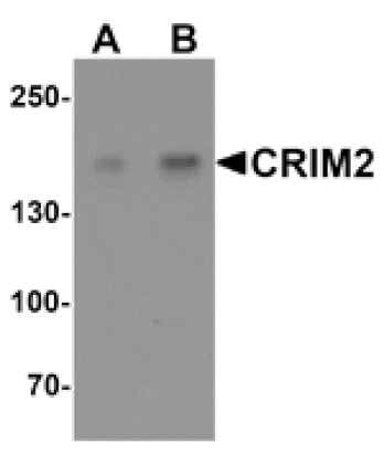 Western blot - CRIM2 Antibody from Signalway Antibody (25517) - Antibodies.com