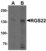 Western blot analysis of RGS22 in Jurkat cell lysate with RGS22 antibody at (A) 1 and (B) 2 µg/mL.