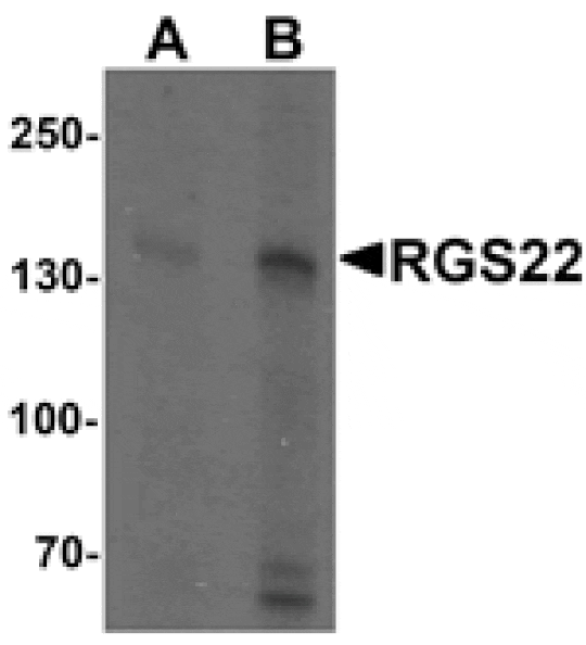 Western blot - RGS22 Antibody from Signalway Antibody (25527) - Antibodies.com