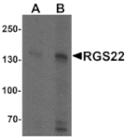 Western blot - RGS22 Antibody from Signalway Antibody (25527) - Antibodies.com