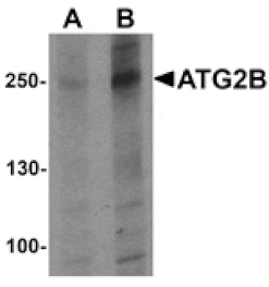 Western blot - ATG2B Antibody from Signalway Antibody (25529) - Antibodies.com